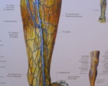 artrozė sustav didelis