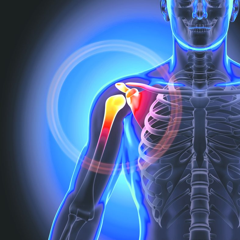 sisteminė artrozė gydymas lėtinis artritas iš alkūnės sąnario