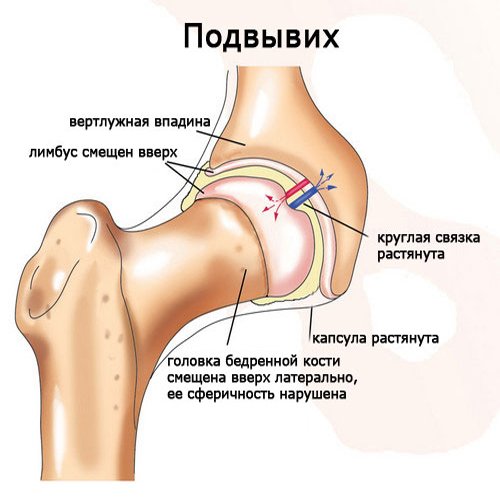 priemonė sąnarių ir ryšulius vaistinė sąnarių liga osteoartrito pirštais rankas
