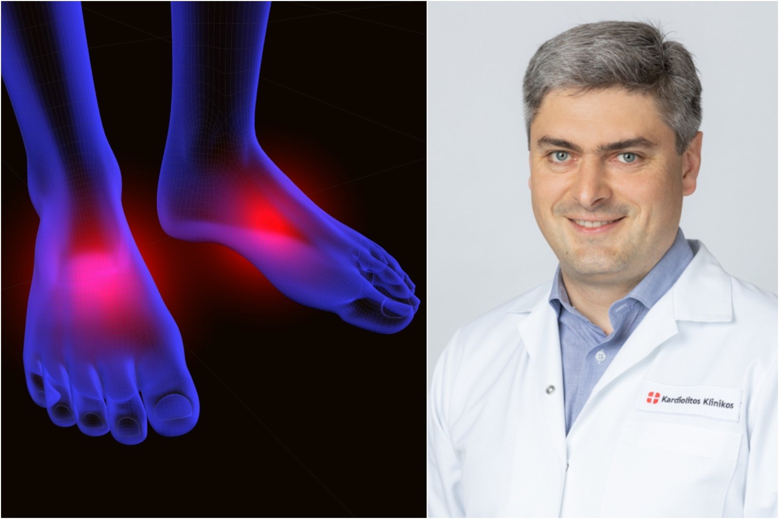 ligos pėdos klasifikavimo sąnarių iš žandikaulio skausmas