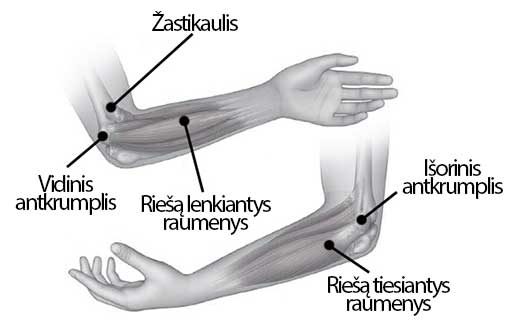 nutirpęs rankos sąnarių artrozė pečių sustaines