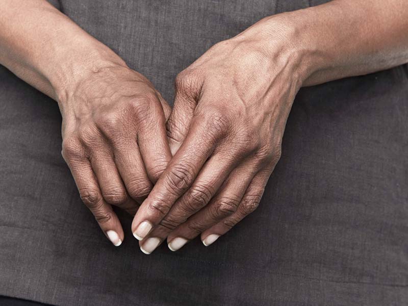 reumatoidinis artritas nykščio dėl rankų gydymo