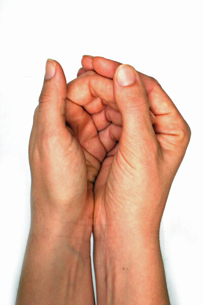 swelling in finger joints causes skausmas nykščiai