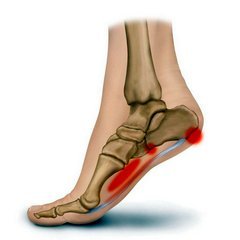 skausmas mažų sąnarių pėdos