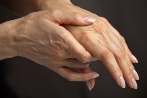 artritas nutirpęs pirštai daryti jei skauda sąnarius