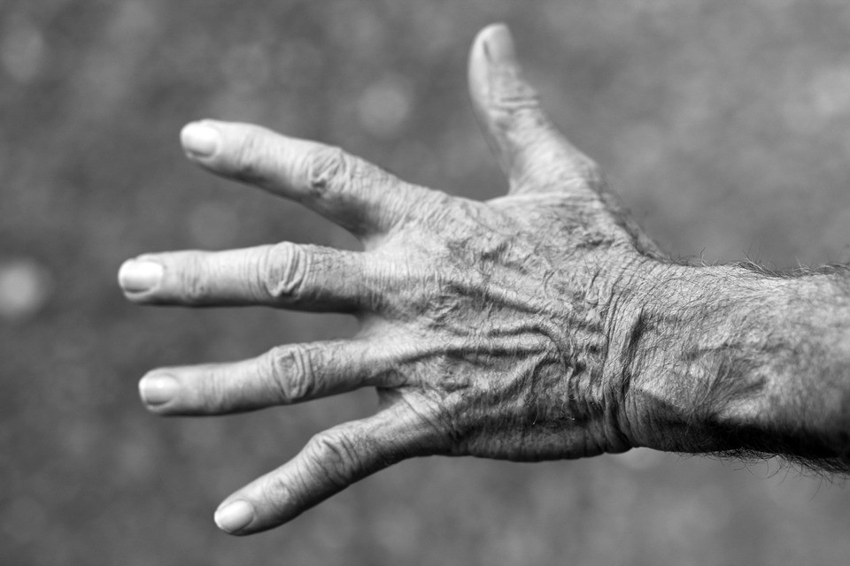 artritas peties gydymui