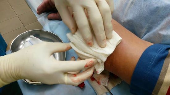 ligos pleceloktevoy sustava swollen painful finger joints pregnancy
