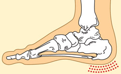 anestetikas skausmas pėdos sąnarių paspaudimus artrito sąnarių