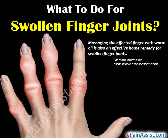 swelling in finger joints causes alyvos nuo sąnarių skausmo