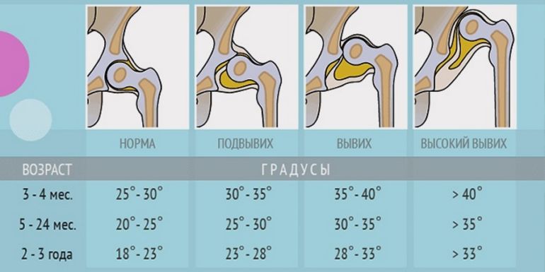 osteopathic gydymo metodas sąnarių skausmas bemps ir sąnarių