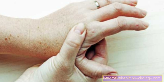 skauda piršto sąnarys ant rankos gydymas skausmas kabinti sąnarių