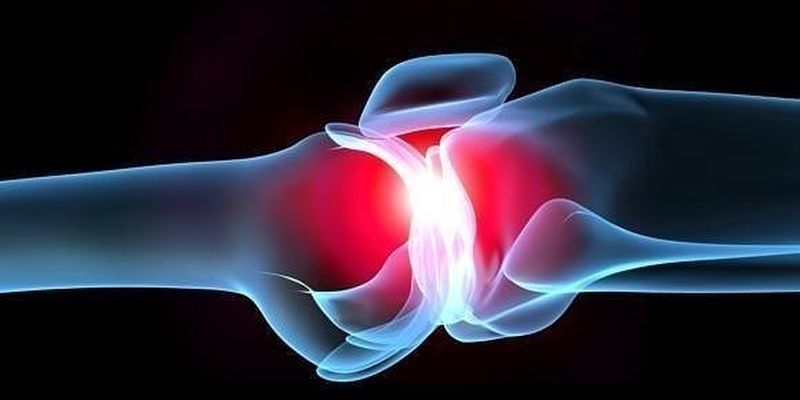 žolės osteoartrito artrito gydymui kas yra sąnarių ir ryšuliai