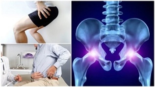 sąnarių skausmas osteoartritas ligų gydymas