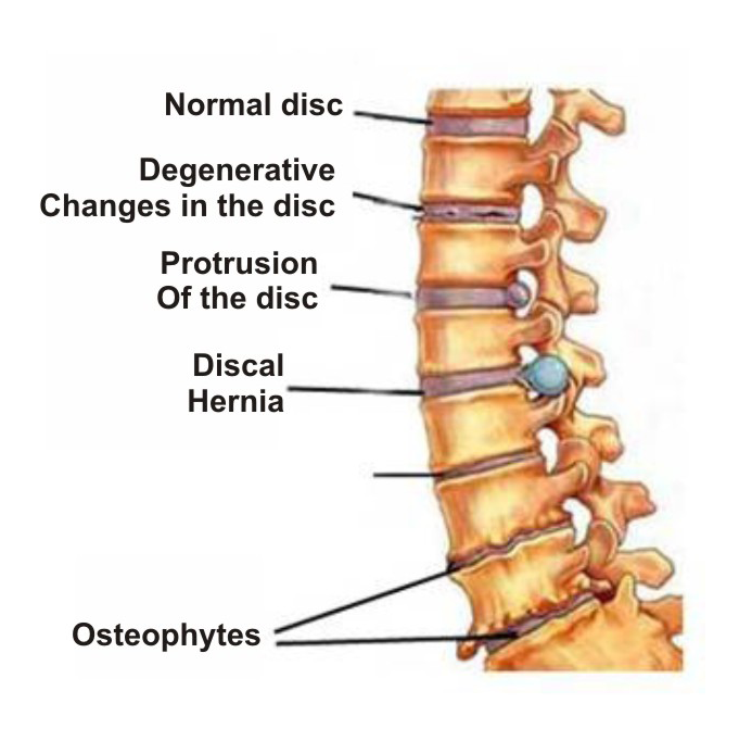 analgetikas skausmo nugaros ir sąnarių