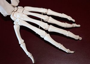liaudies gynimo priemonės gydant osteoartritą rankas užpilai skausmo sąnariuose