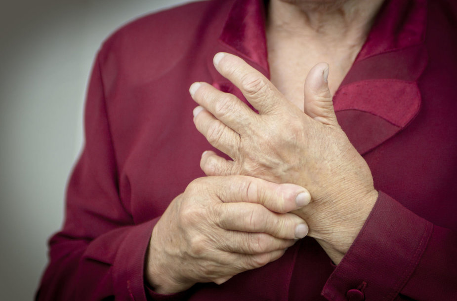 artritas iš pėdos sąnarių prevencija alkūnės sąnario