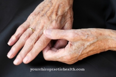 patogenezė uždegimas sustava gydymas artritas iš pirštų galų gydymo sąnarių
