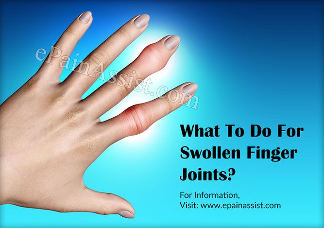 swollen painful joints in hands