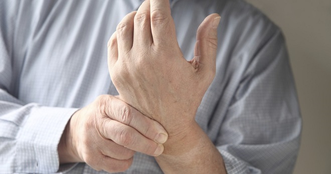 artritas pasireiškia kaip rankų