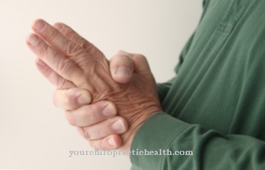 liejimo rankų gydymas artritas rankų sąnarių