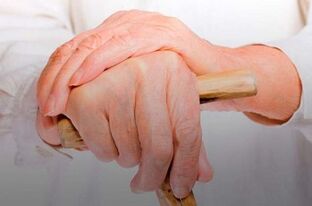 skausmas tepalo pirštais sąnarių medicinos tepalas nuo osteochondrozės