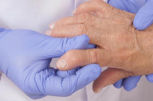 chondroitino gliukozamino kainą apžvalgos analogai infekcinio artrito rankų šepečiai