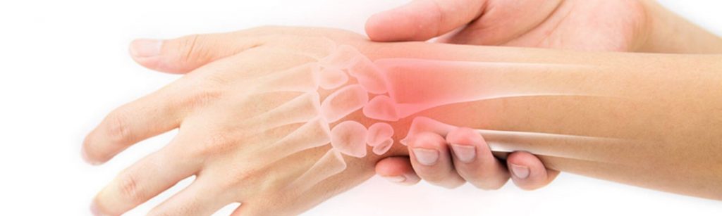 kas yra pavojinga artrozė sąnarių skausmai skausmas sąnarių