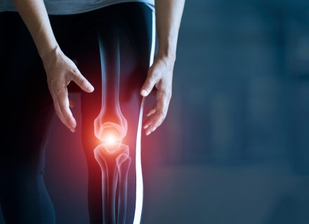 nei gydyti osteoartrito alkūnės