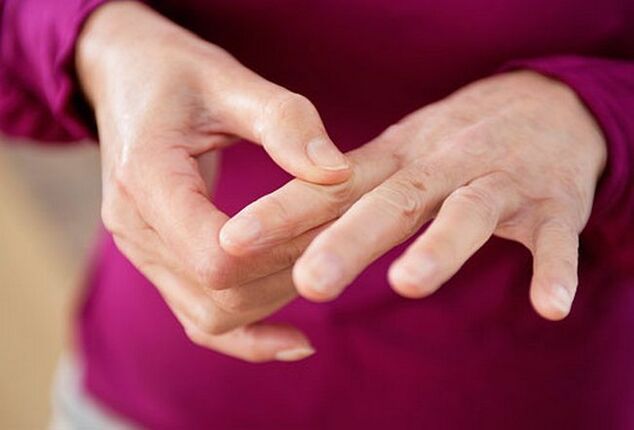 rankų plėtra artritu