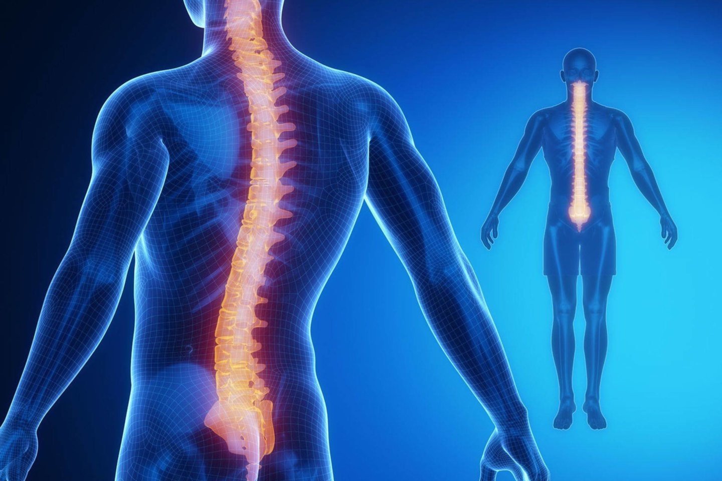kaip atsikratyti nugaros skausmo ir sąnarių skausmas artritas iš alkūnės sąnario patinimas