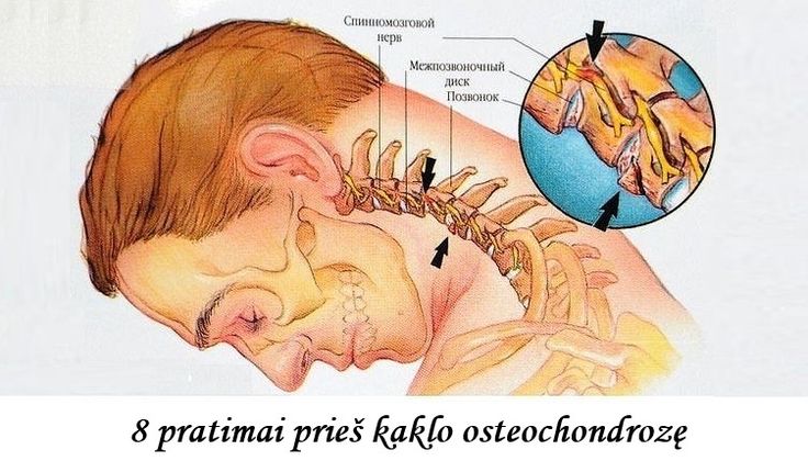 kaklo osteochondrozė galvos svaigimas kauno klinikos burnos chirurgas registracija