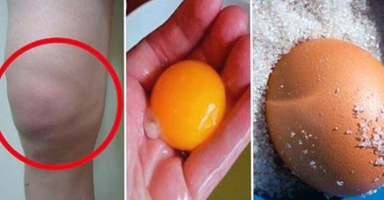 kiaušinio baltymo gydymas sąnarių laikykite nuo rankos pirštų sąnarius skauda šepetys gerklės riešo