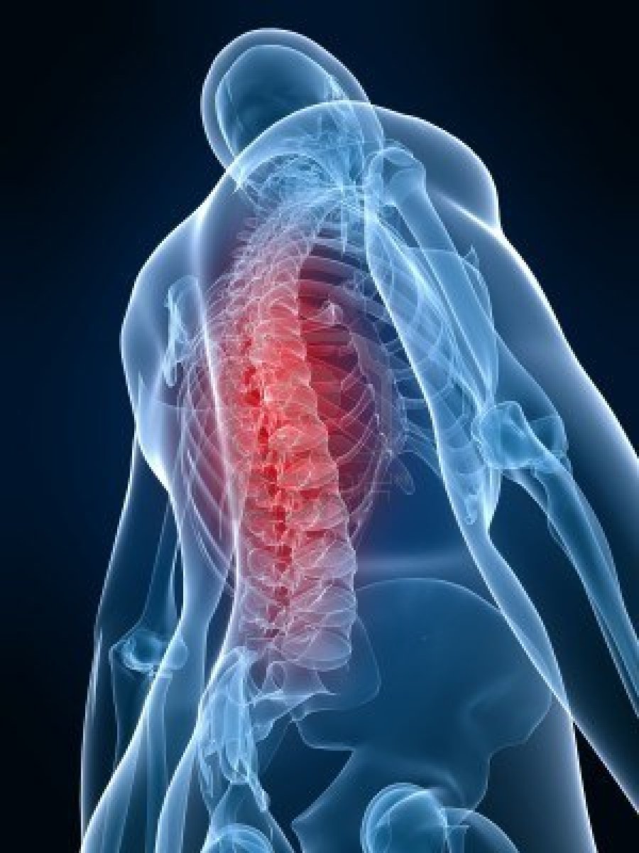 nugaros skausmas ir sąnarių skausmas priežastys ir gydymas tepalas nuo sąnarių vaistinėse