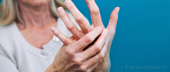 reumatoidinis artritas pozymiai