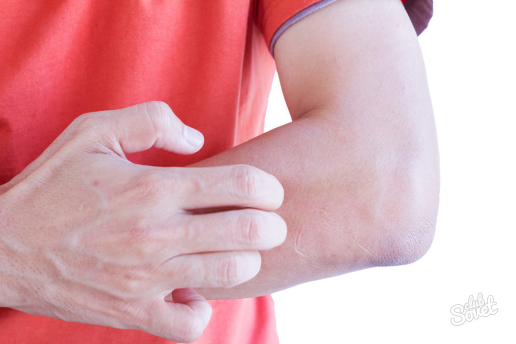 rankų bendra edemą skausmas dešiniojo klubo sąnario