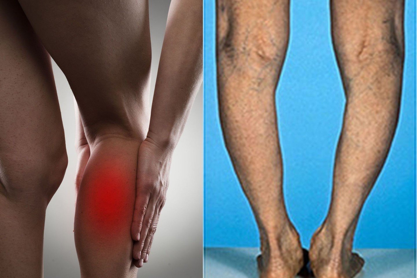 silpnumas skausmas raumenų ir sąnarių skausmas juosmens skausmas pereinantis i kaire koja