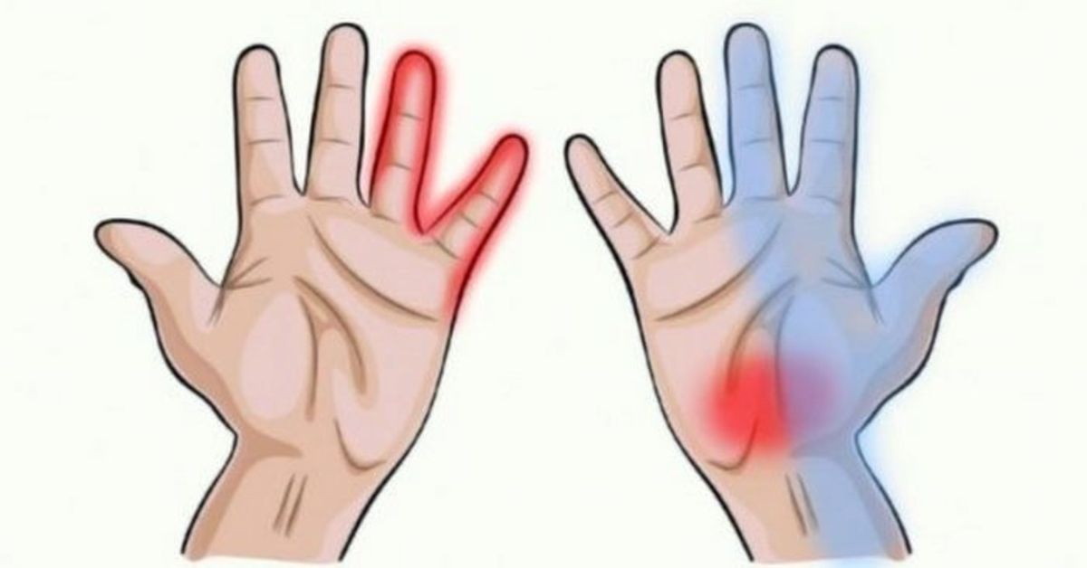skausmas peties sąnario dešinės rankos ir tirpulys pirštų sustaines skauda su stresu