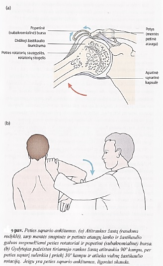 kaip išbandyti save susirgus sąnarių patikrinkite rankas ant artrito