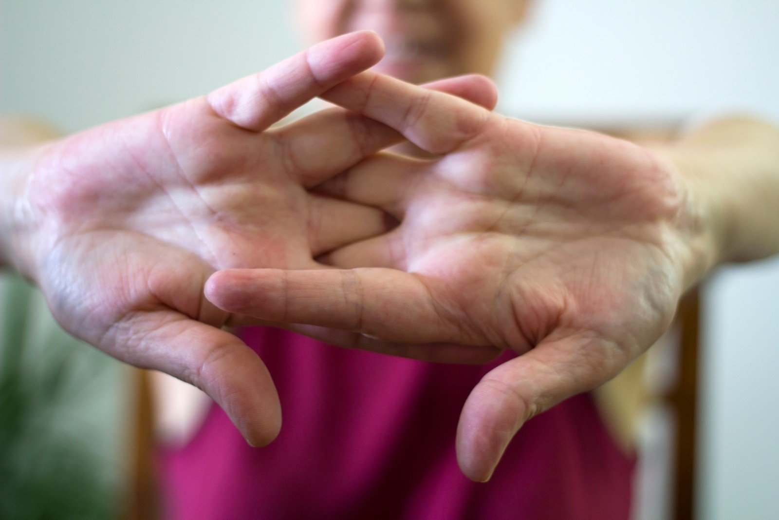 dugootroschatyh artritiniu sąnarių l4-s1 artritas pasireiškia kaip rankų