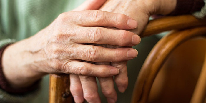 graikų artritas rankų stiprus ciurnos skausmas