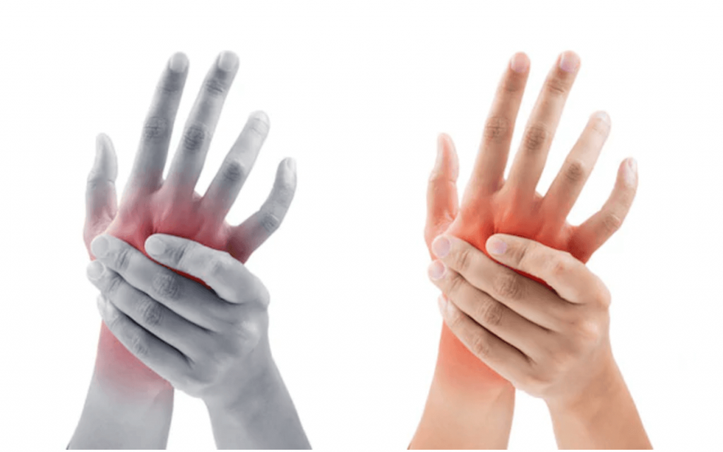 skausmas peties sąnario dešinės rankos ir tirpulys pirštų chondroitino gliukozamino kompozicija kainą