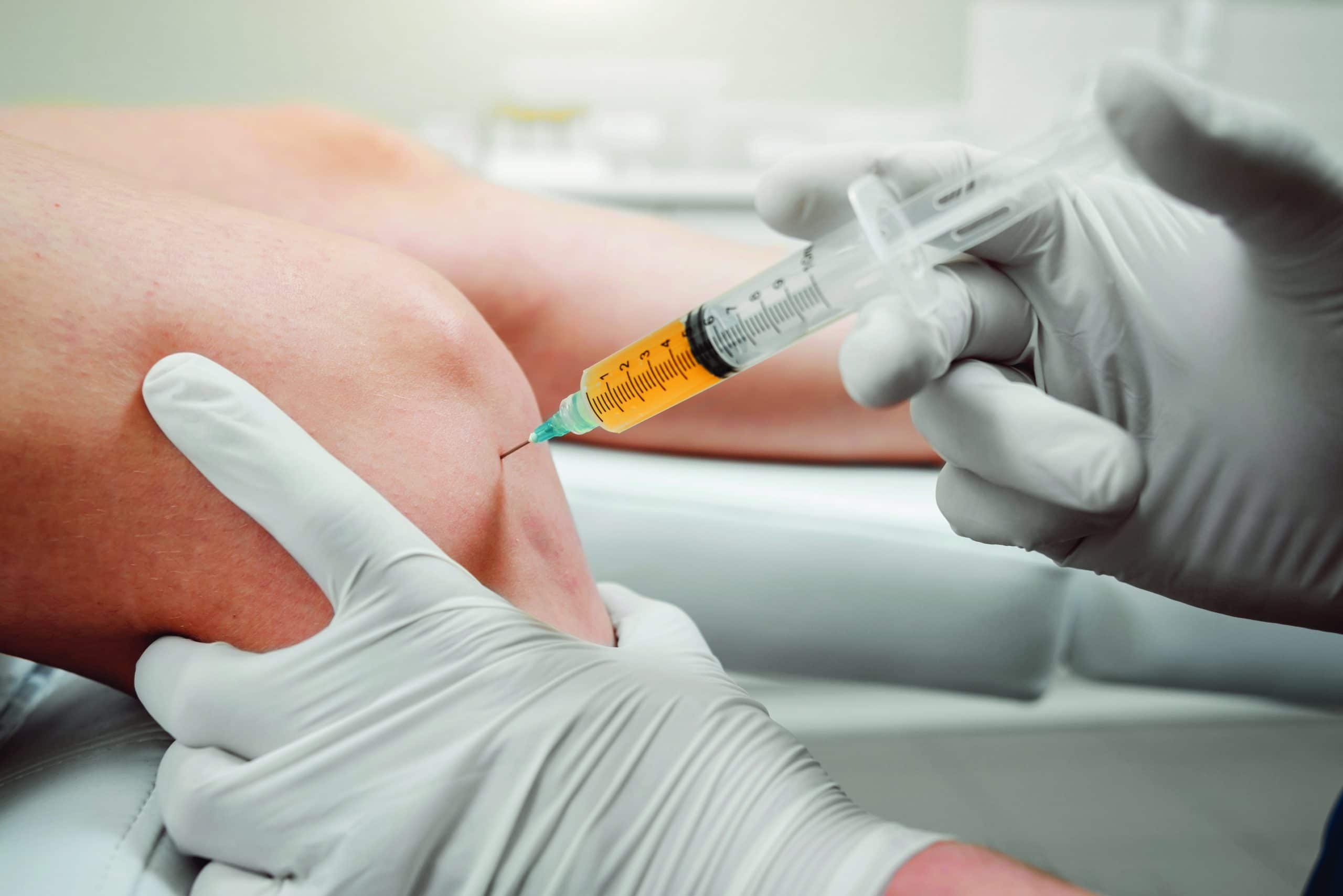 injekcinis sąnarių gydymo kodel skauda kaire krutines puse