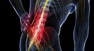 kaip atsikratyti nugaros skausmo ir reumato sąnarių skausmas