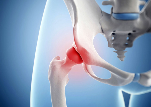 reumatoidinis artritas vaistai sąnarių esantys osteochondrozės