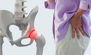 skausmas iš į liaudies gynimo gydymo priežastis sąnarių osteochondrozė ir greitai gelis