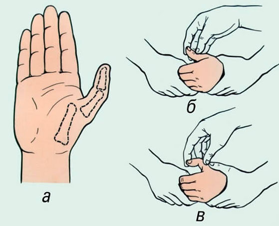 gerklės sąnarių ant rankų šepečiai gydymo artrozės iš žemės ūkio sąnarių metu