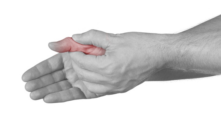 kad trigerius artrito rankas astin bendrą grietinėlės kaina