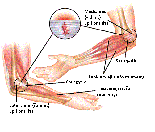 kojos rieso skausmas