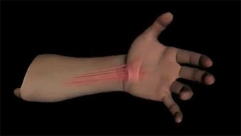 ką daryti su jungtiniame ant rankų skausmo