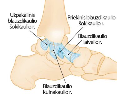 pašalinti skausmas pėdos sąnarių artritas artrito ligoms gydyti